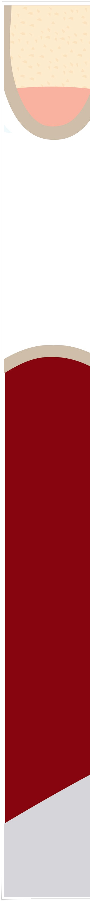 명동치과 치아가 욱씬욱씬 아프신가요? 관련 이미지 28