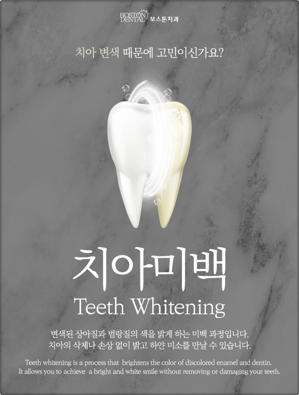 종각치과 누런치아 어떻게 해결하면 좋을까요? 전문가 치아미백 가이드 관련 이미지 3