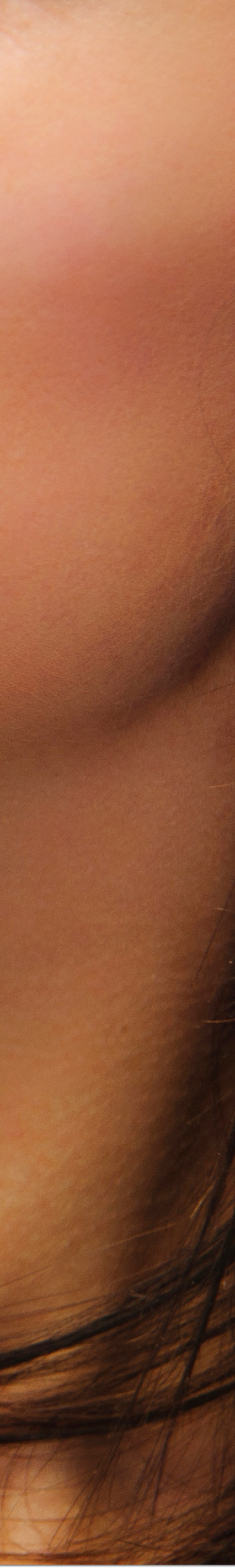 광화문역치과 라미네이트 치료가 궁금해요 관련 이미지 38