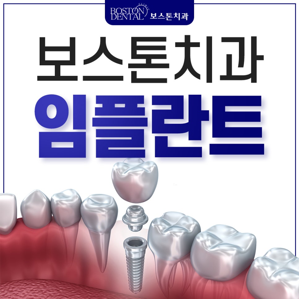 🦷임플란트 정확하게 식립 합니다! 관련 이미지 1
