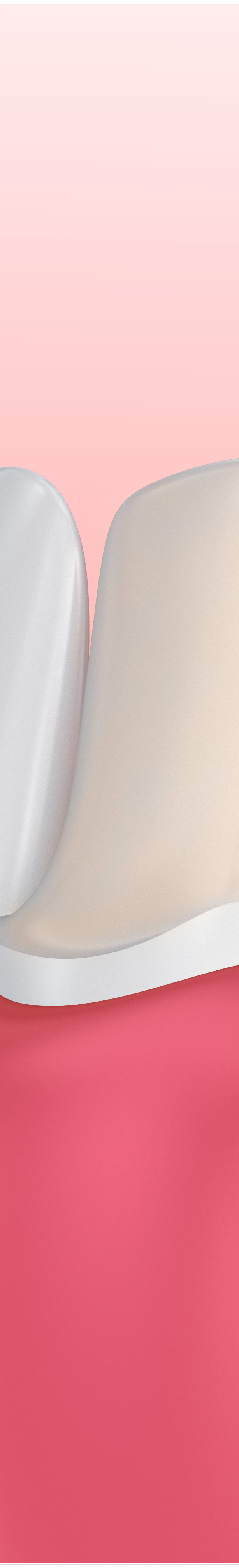 명동치과 라미네이트로 환하게 스마일~ 관련 이미지 23