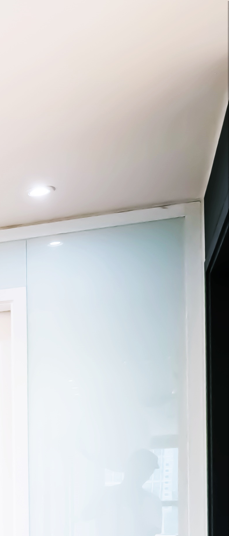 종각치과 임플란트에 대해 알아두어야 할 정보들 모아모아 관련 이미지 11