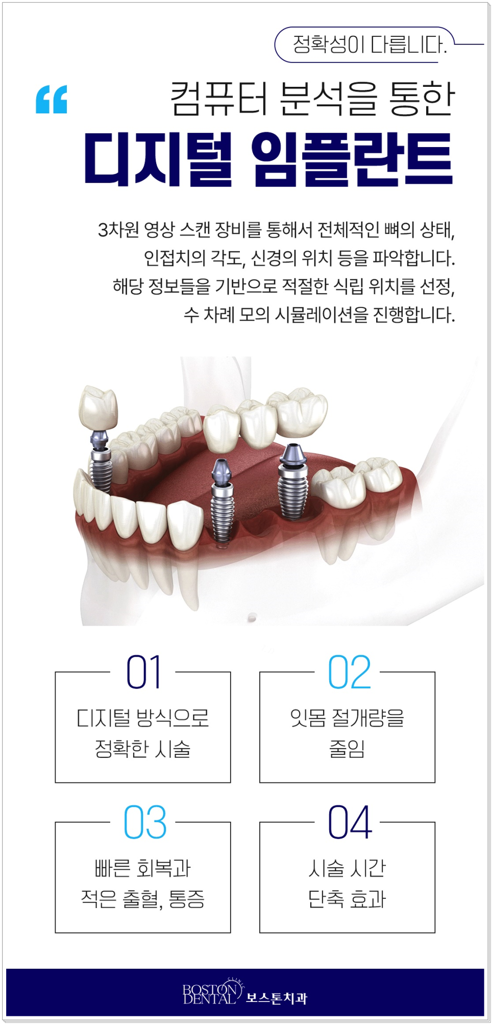 종로임플란트 이제는 걱정 말고 편안하게 관련 이미지 4