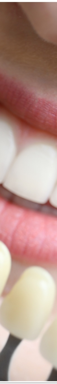 광화문역치과 생활습관에 따른 맞춤형 미백 관리 관련 이미지 31