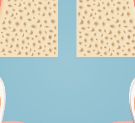 종로치과 충치가 생겼을 때 어떻게 치료 받아야 하나요? 관련 이미지 14