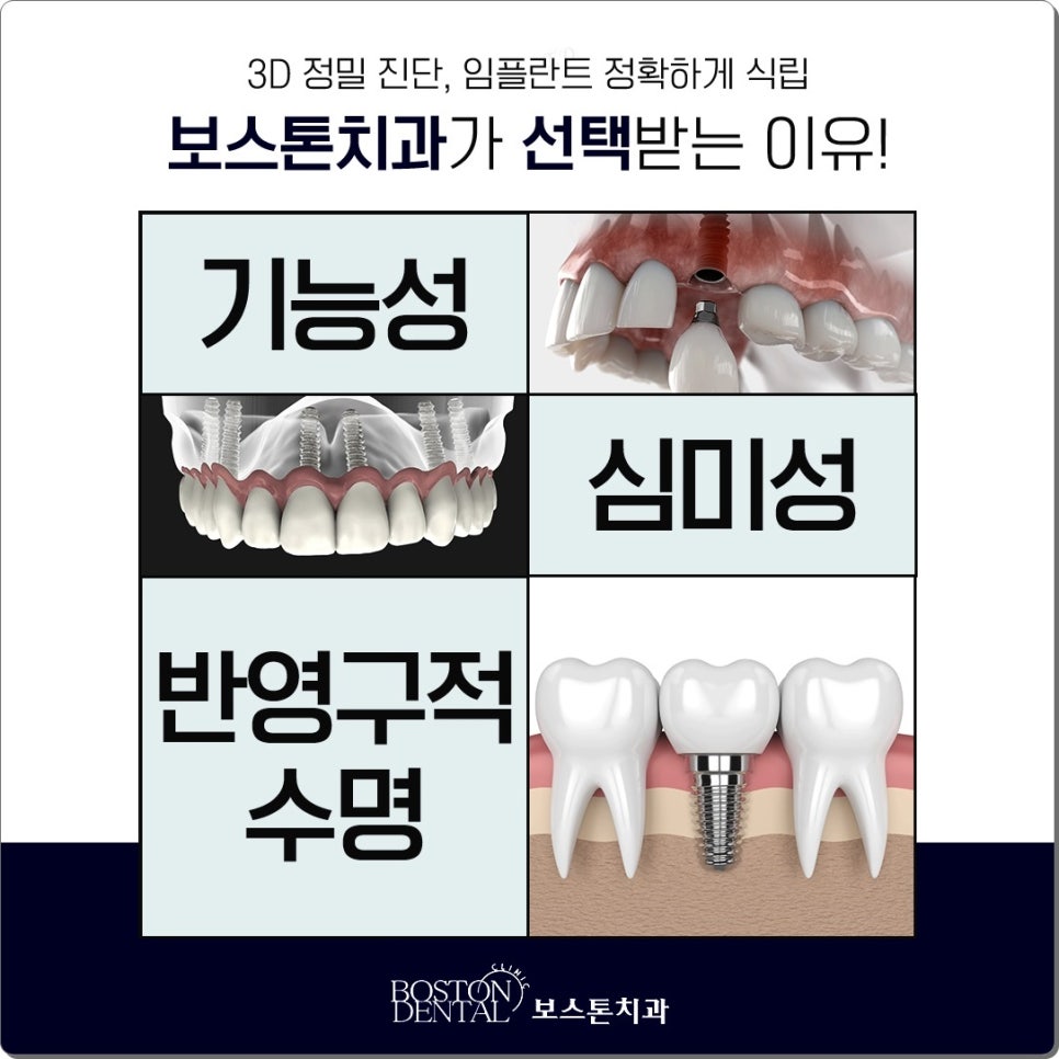 명동치과 임플란트 한 후에 먹는 음식들 관련 이미지 7