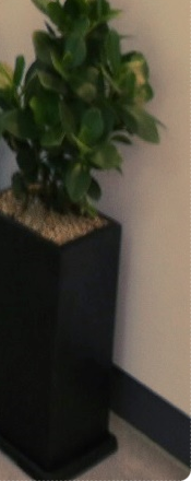 종로임플란트 이제는 걱정 말고 편안하게 관련 이미지 59