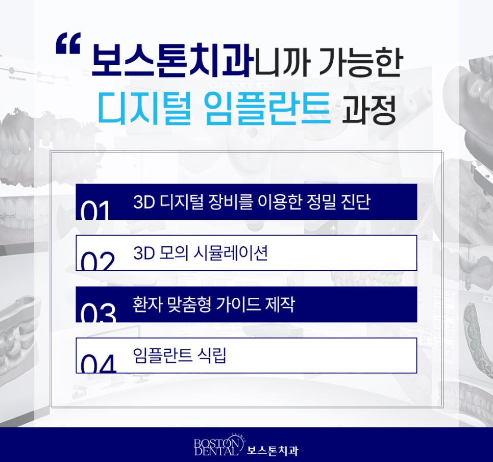 종각역치과 임플란트 정밀 확인 후 식립 합니다. 관련 이미지 5