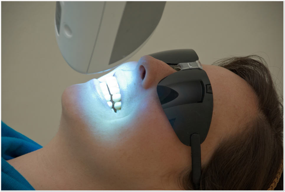 명동역치과 치아 미백, 궁금했던 모든 것 - 오해와 진실 관련 이미지 9