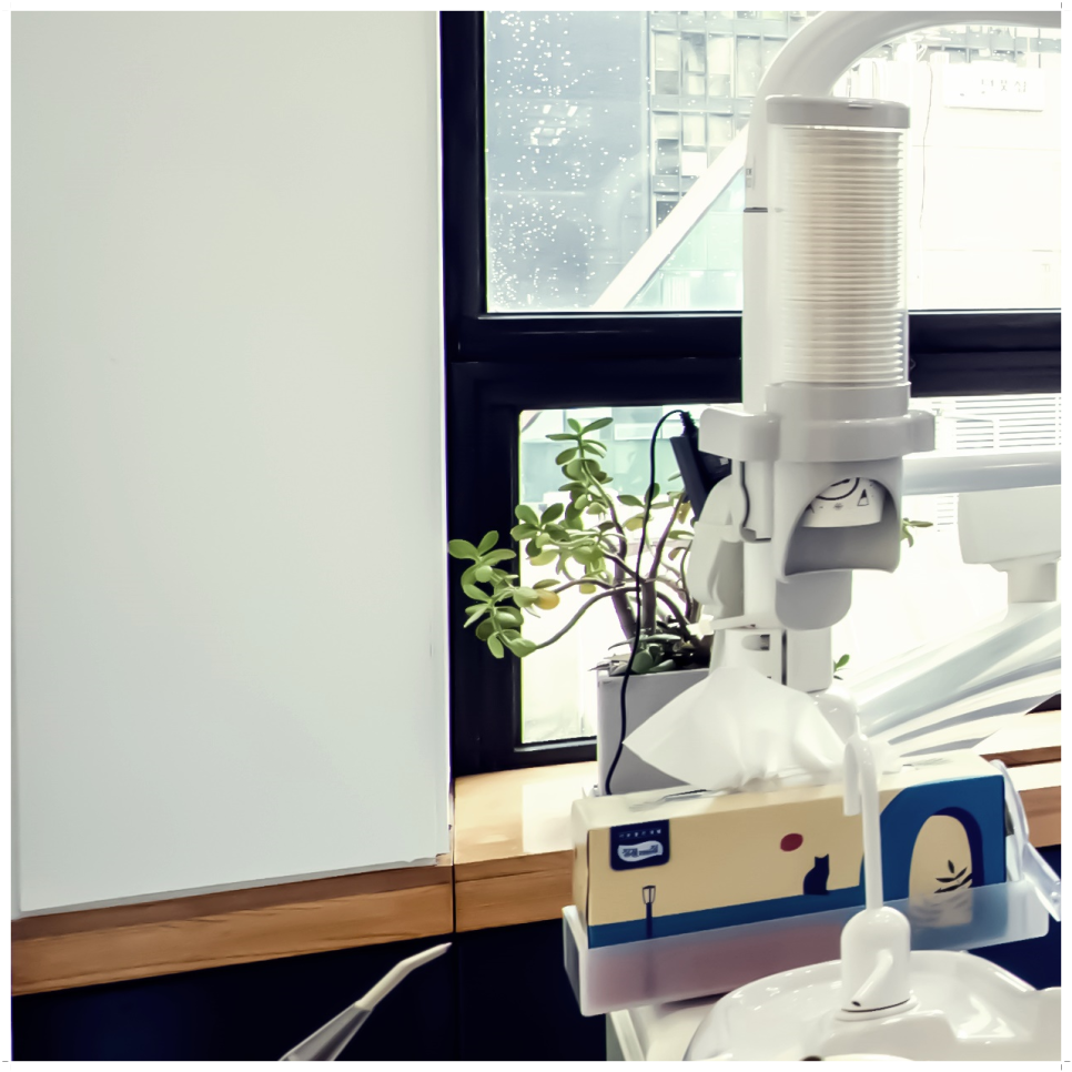 종로치과 마무리까지 확실하게 관련 이미지 30