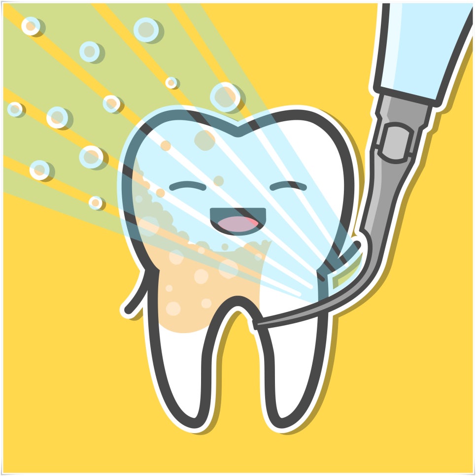 스케일링 하고 나서 주의할 점은? 관련 이미지 3