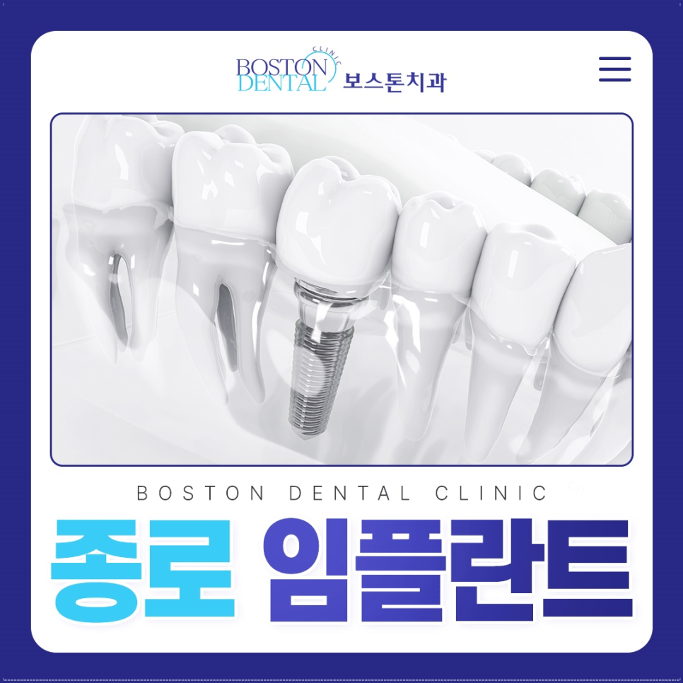 종로임플란트 첨단장비로 분석하여 식립 관련 이미지 1
