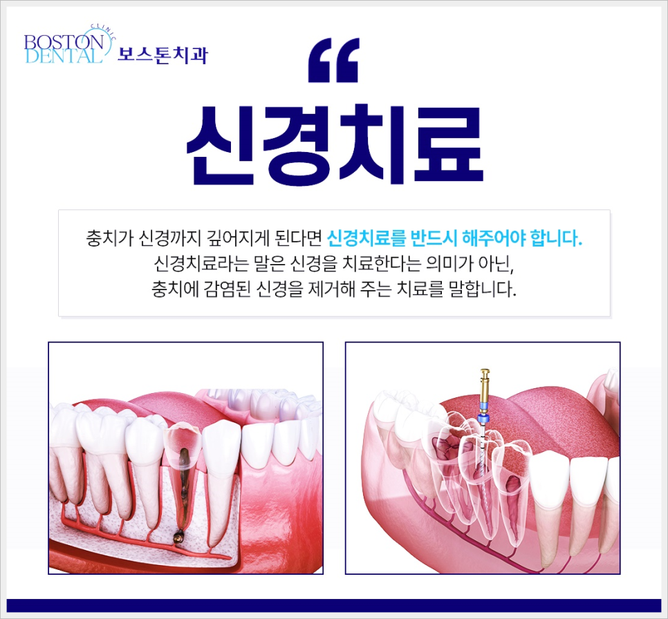 광화문역치과 이가 시리고 아프다면? 관련 이미지 4