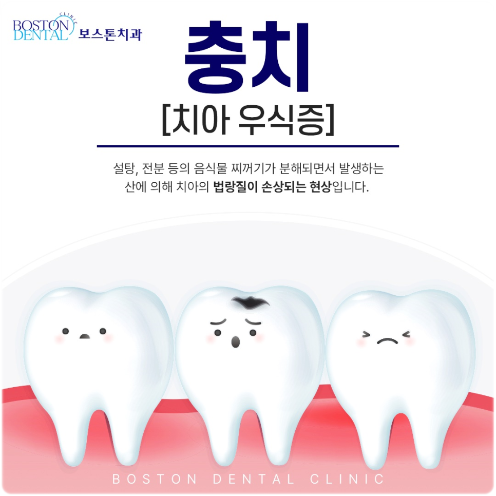 종각역치과 점심시간 이용해서 치료받을 수 있습니다! 관련 이미지 2