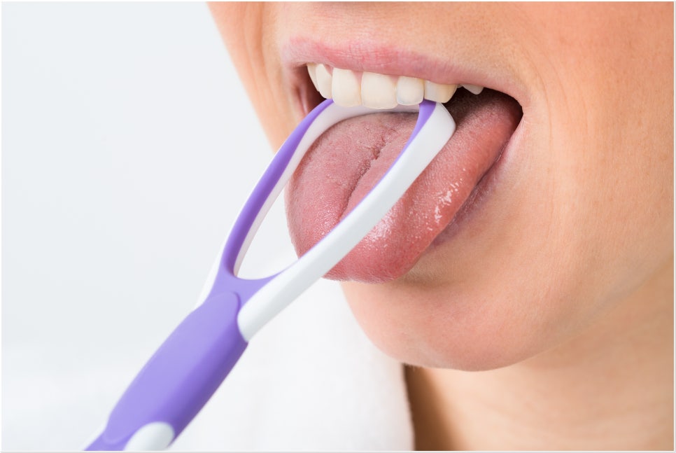 혀가 하얗게 변했다면? 원인과 치료 방법 관련 이미지 3