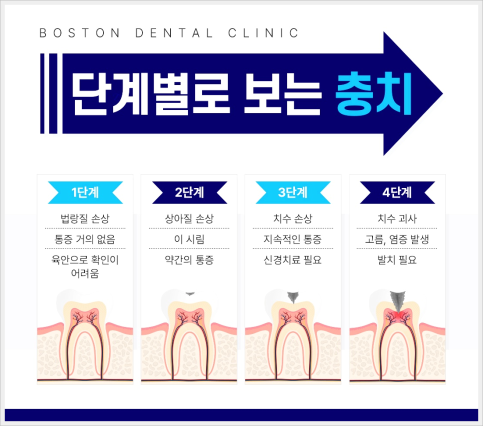 광화문역치과 이가 시리고 아프다면? 관련 이미지 3
