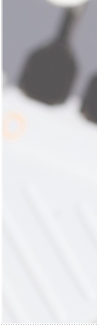 종로치과 라미네이트 주변 치아를 확인하여 자연스럽게 관련 이미지 17