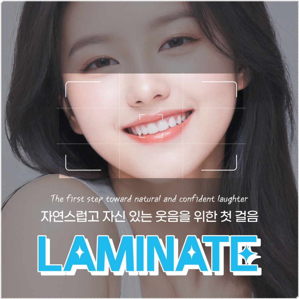 종로치과 라미네이트 주변 치아를 확인하여 자연스럽게 관련 이미지 6