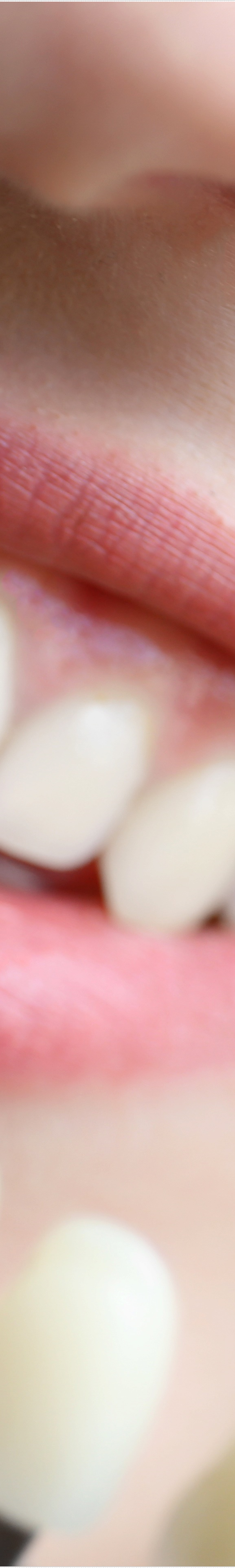 을지로입구역치과에서 알려드리는 치아미백과 라미네이트의 모든 것 관련 이미지 23