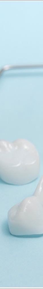 광화문치과 라미네이트 치료 전 고민해야 할 것 관련 이미지 36