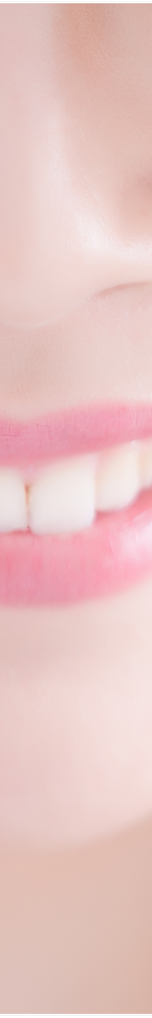 명동치과 라미네이트로 환하게 스마일~ 관련 이미지 11