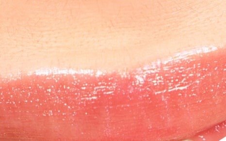 종로치과 치아미백 밝고 환하게 관련 이미지 17