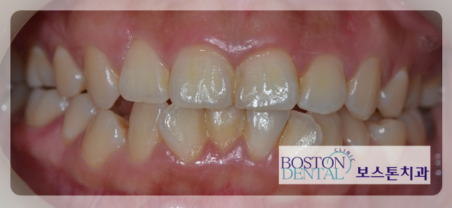 종각역치과추천 꼭 필요한 치료만! 관련 이미지 4