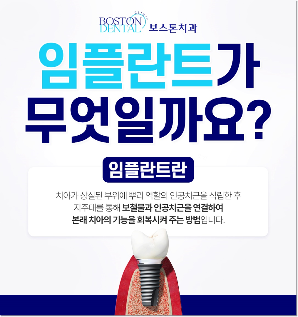 종각치과 임플란트에 대해 알아두어야 할 정보들 모아모아 관련 이미지 2