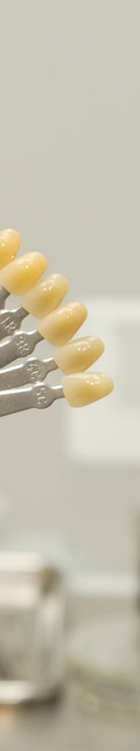 을지로입구역치과 치아미백으로 하얀 미소 찾기 관련 이미지 13