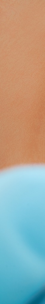 광화문치과 치아미백 그 후 관련 이미지 8