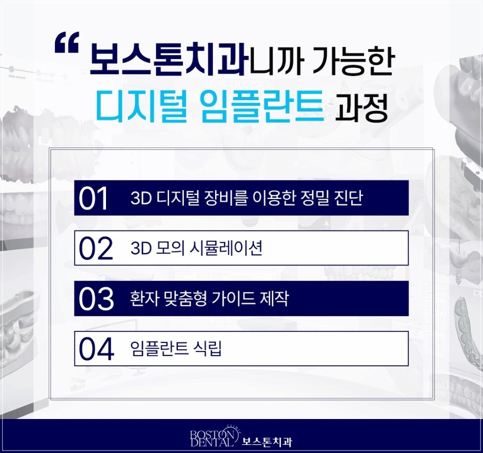 종각치과, 노화로 치아 상실을 겪으면 임플란트를 관련 이미지 3