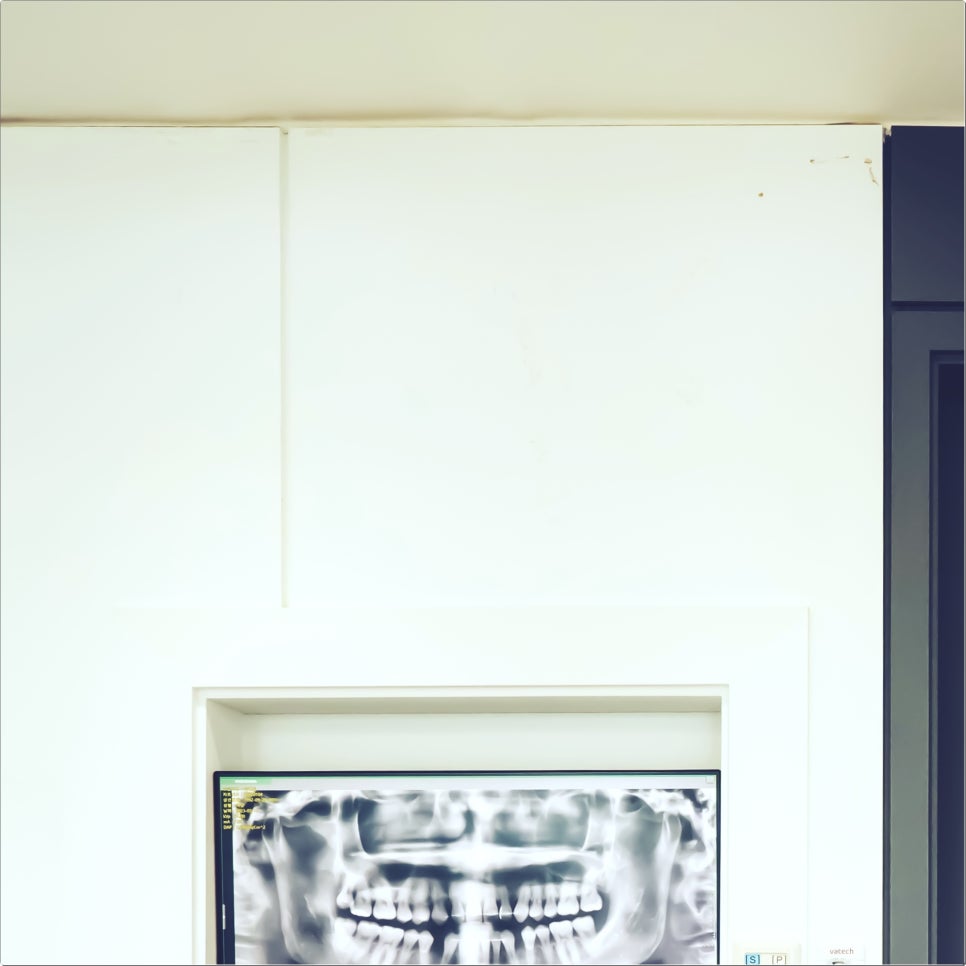 종각역 치과 임플란트 잘 마무리하기 위해서 관련 이미지 21