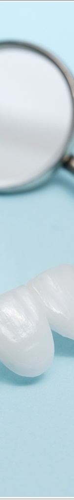 광화문치과 라미네이트 치료 전 고민해야 할 것 관련 이미지 39