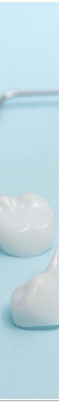 광화문역치과 치아미백과 라미네이트 나에게 필요한 건? 관련 이미지 38