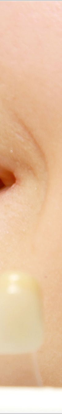 명동라미네이트, 단시간에 환한 미소를 가지고 싶다면? 관련 이미지 13