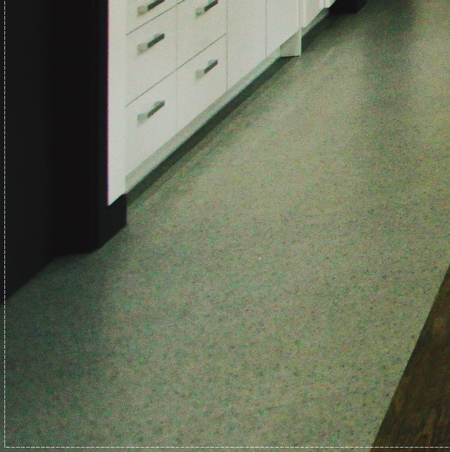 을지로치과 투명해서 티가 안 나게 교정할 수 있어요 관련 이미지 38