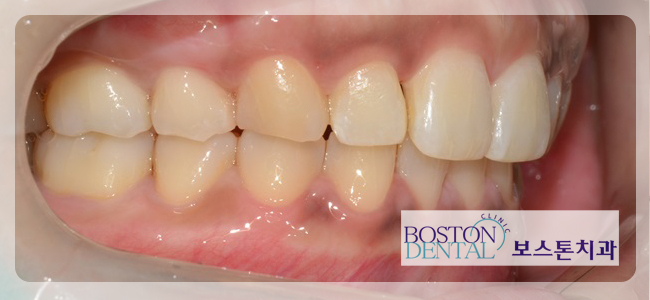 종각역치과추천 꼭 필요한 치료만! 관련 이미지 8