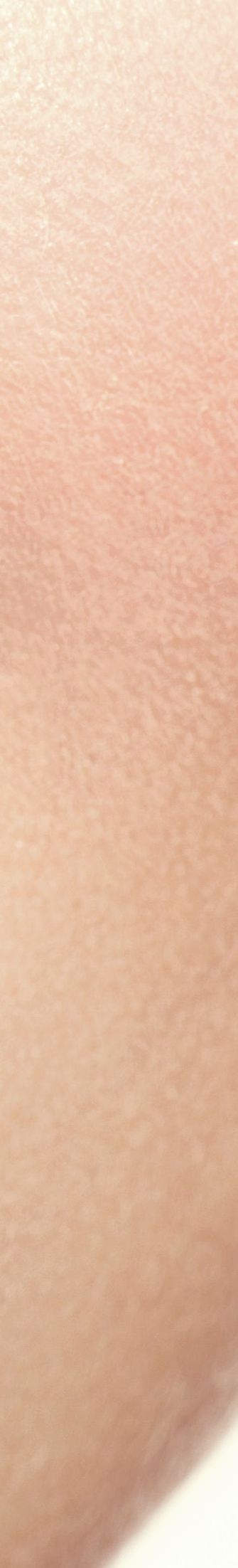 광화문역치과 치아미백과 라미네이트의 차이는? 관련 이미지 12