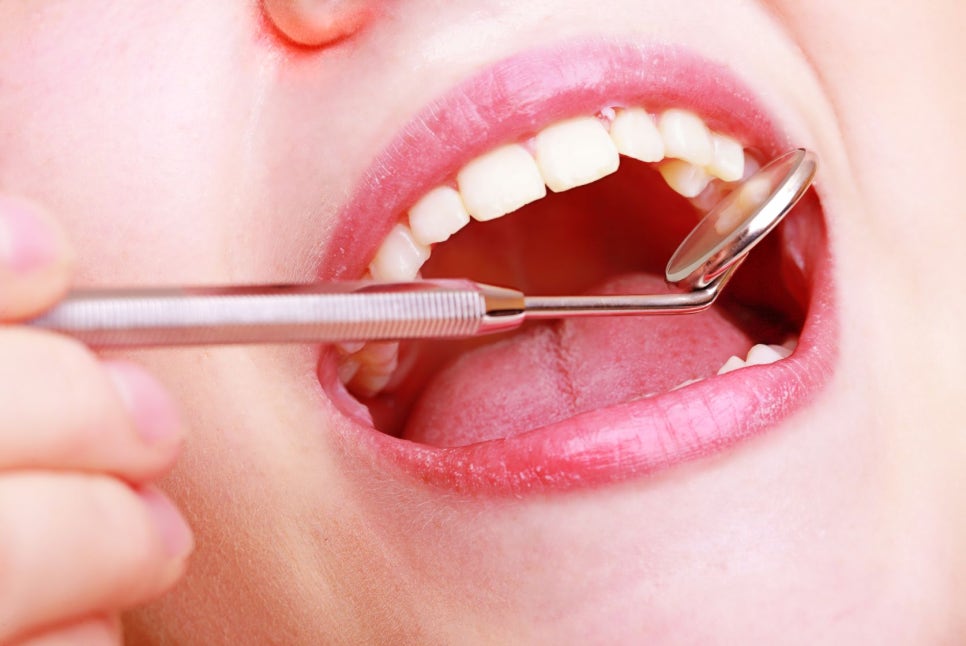 Euljiro Dental Clinic: An Oral Health Care Guide for Busy Office Workers image 2