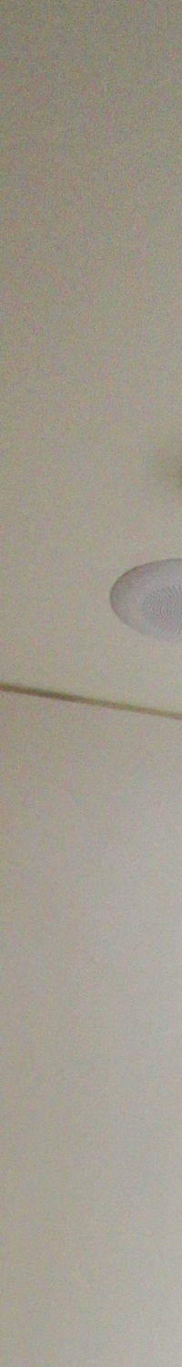 명동역치과 일상생활 중 치아가 흔들린다면 관련 이미지 9