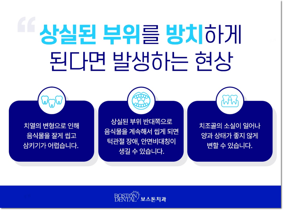 명동치과 상실부위는 임플란트로 관련 이미지 4