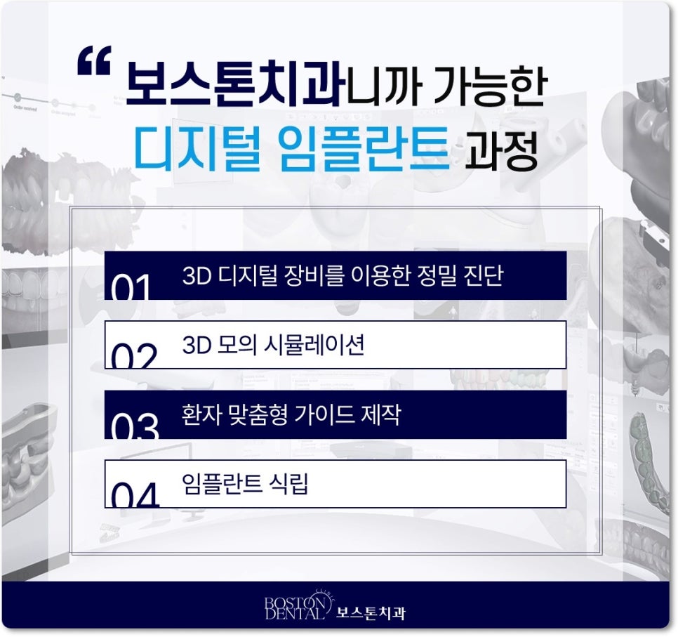 종로구치과 임플란트에 대해서 알고 싶으시다면? 관련 이미지 7