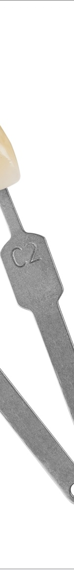 광화문치과 라미네이트 치료 전 고민해야 할 것 관련 이미지 6