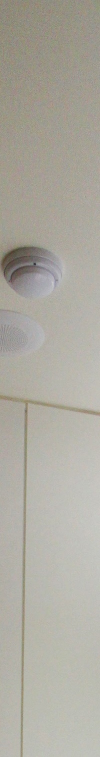 명동역치과 일상생활 중 치아가 흔들린다면 관련 이미지 10