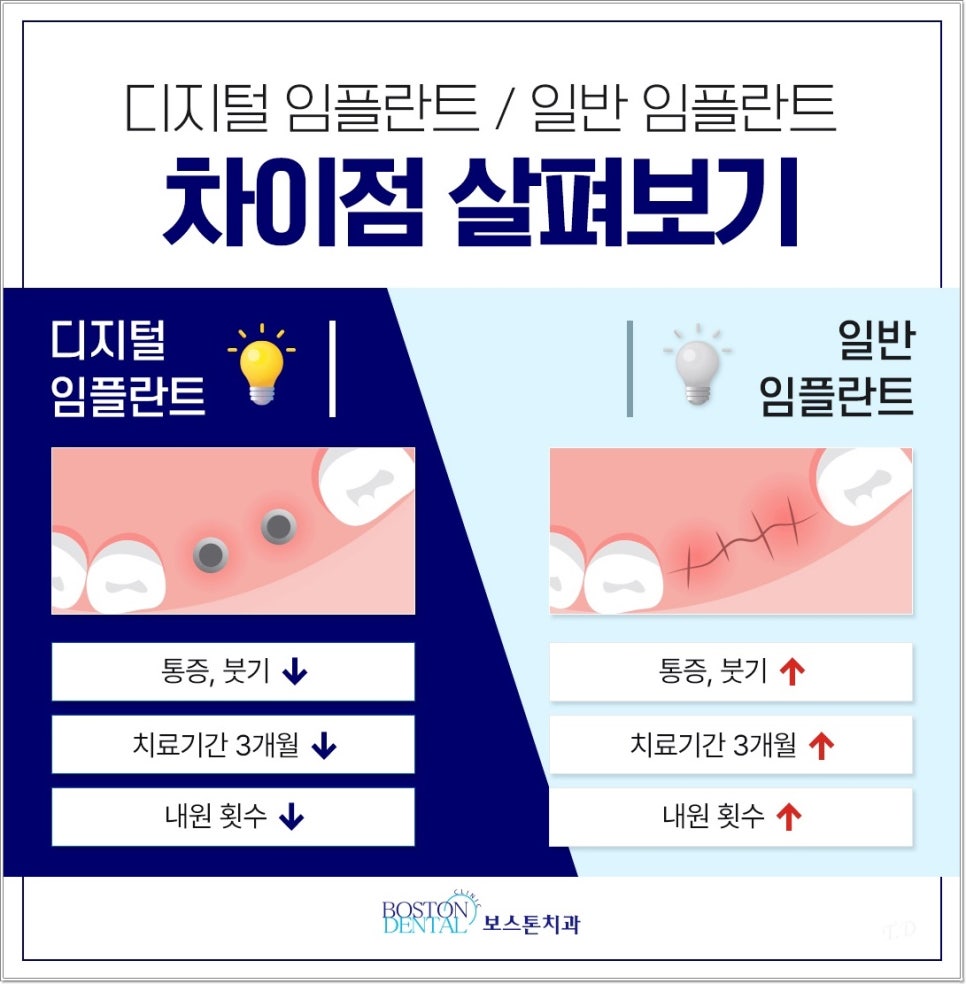종로야간진료치과 임플란트 잘 마무리하려면? 관련 이미지 5