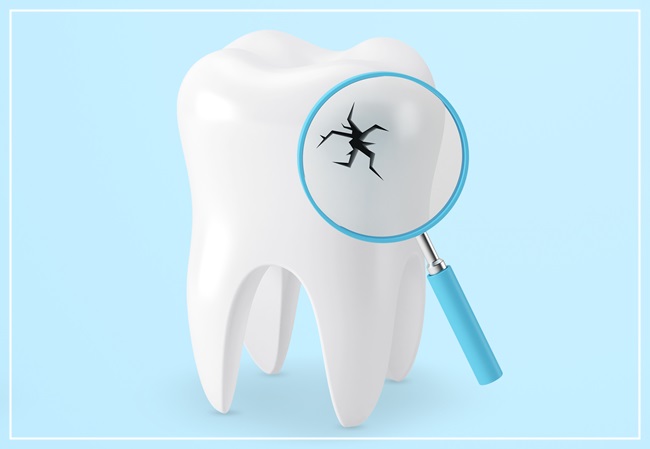 치아마모증에 대한 모든 것! 관련 이미지 2