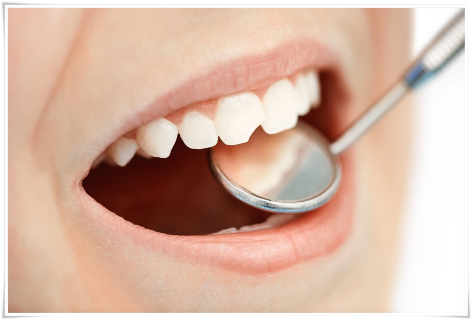 스케일링 하고 나서 주의할 점은? 관련 이미지 2