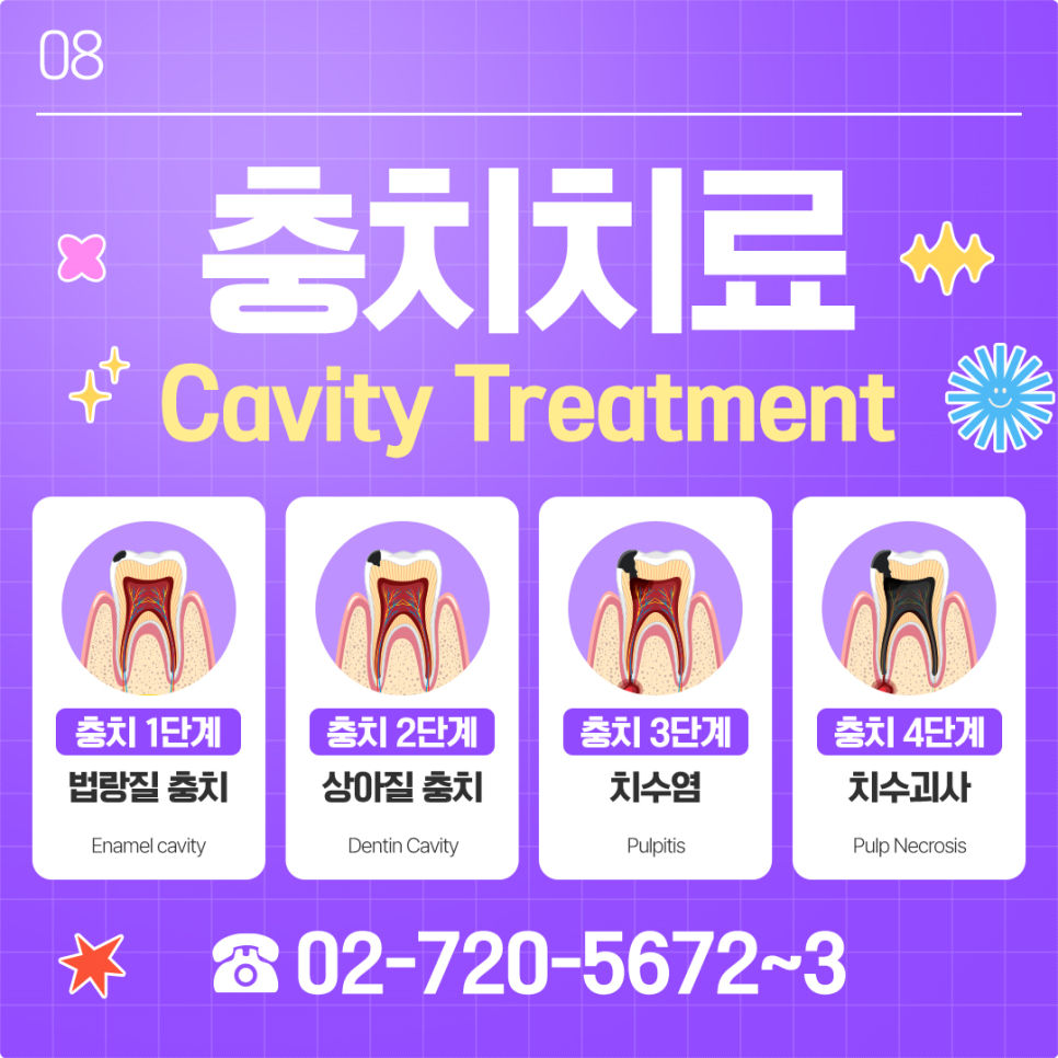 외국인 충치 치료 한국에서 할까 고민 중이라면? 관련 이미지 3