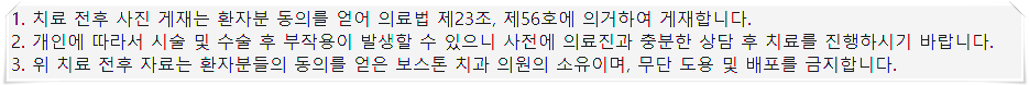 종로3가치과 틀니 사용 중인데 불편해서 임플란트 하고 싶어요 관련 이미지 4