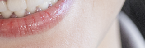 Euljiro Dental Clinic: An Oral Health Care Guide for Busy Office Workers image 15